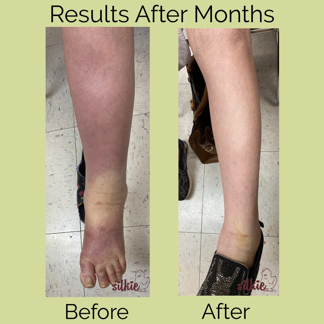 Mini Consultation: A 15 minute brief consultation to evaluate your health concerns, give herbal formula recommendations and answer your questions.