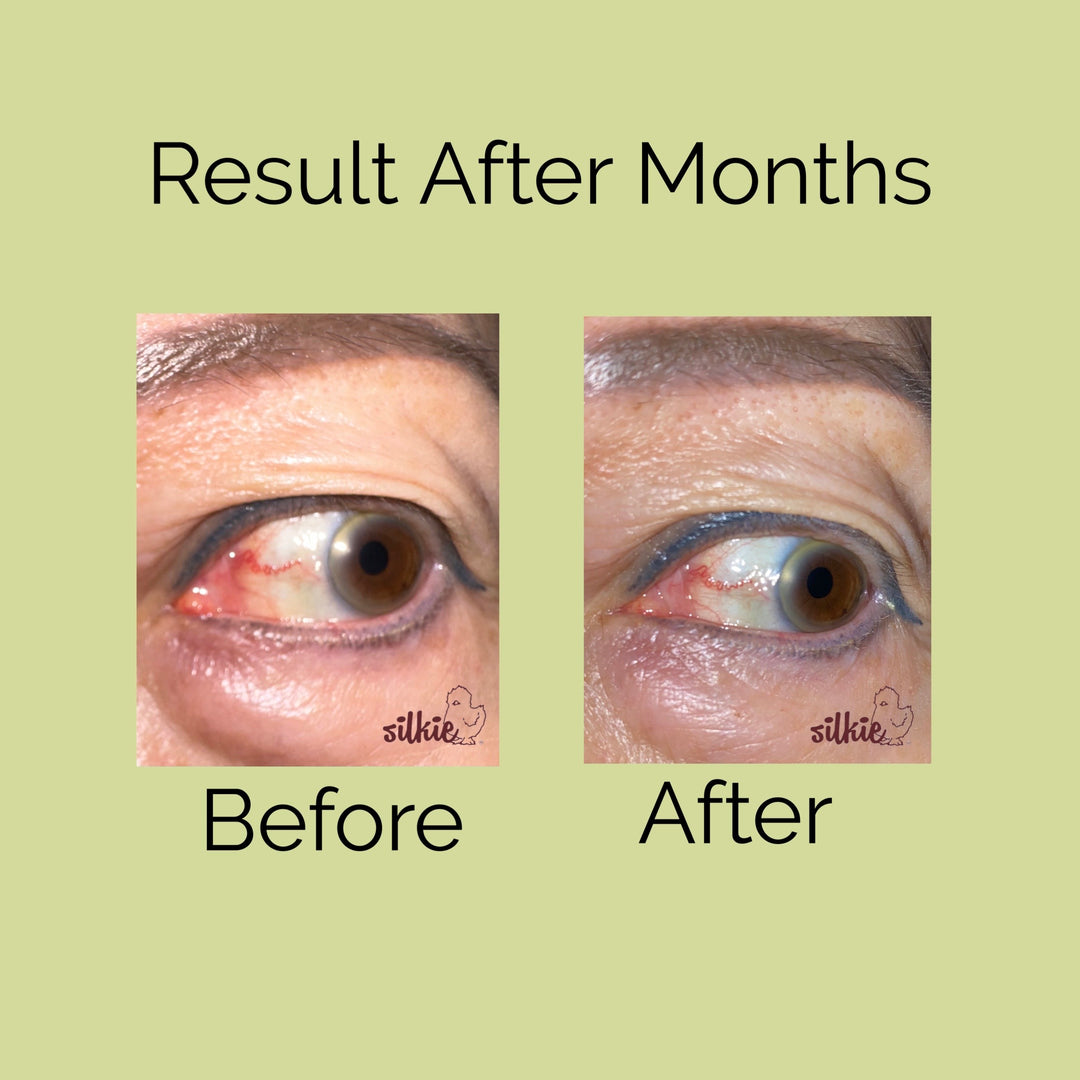 Mini Consultation: A 15 minute brief consultation to evaluate your health concerns, give herbal formula recommendations and answer your questions.