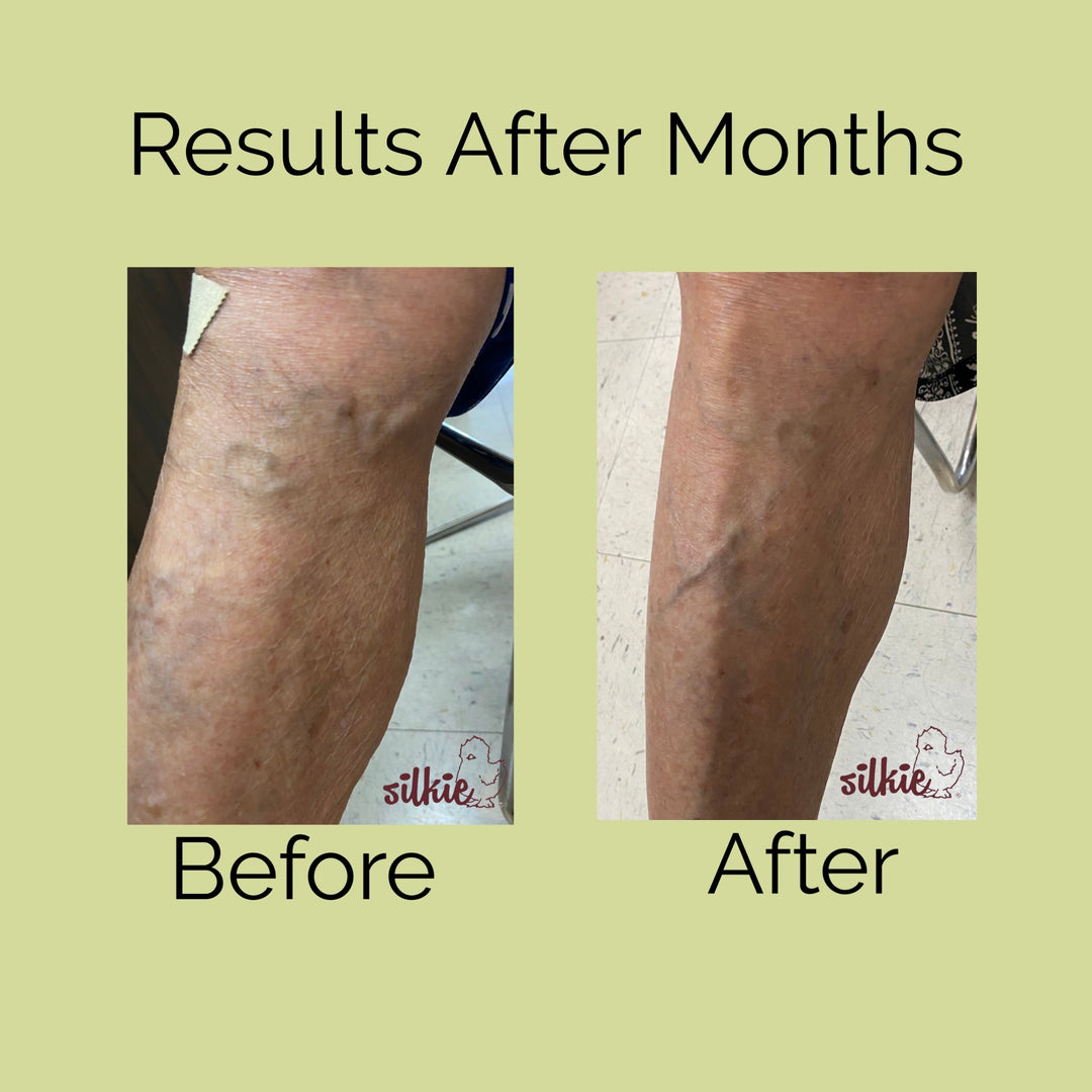 Mini Consultation: A 15 minute brief consultation to evaluate your health concerns, give herbal formula recommendations and answer your questions.