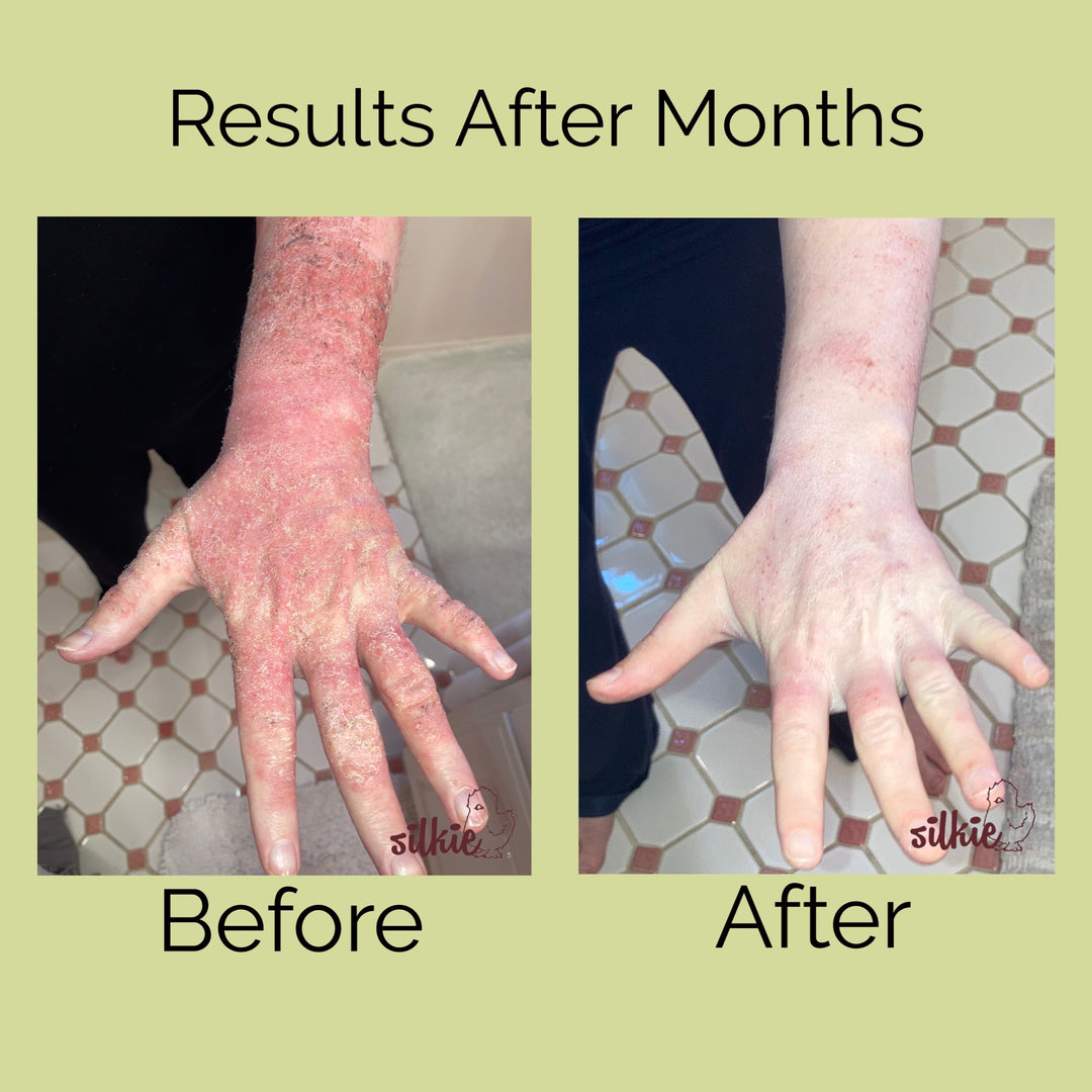 Mini Consultation: A 15 minute brief consultation to evaluate your health concerns, give herbal formula recommendations and answer your questions.