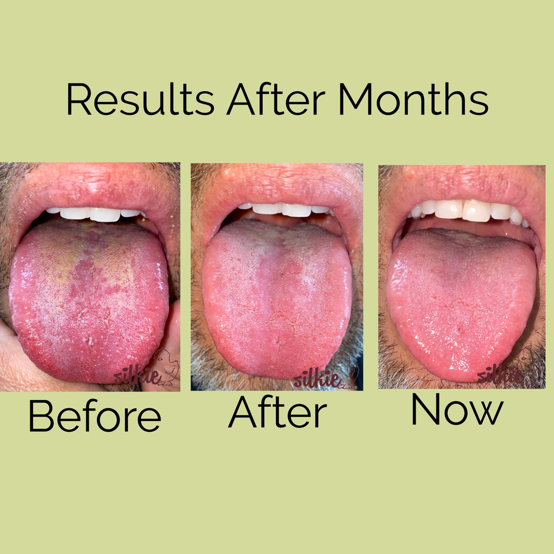 Mini Consultation: A 15 minute brief consultation to evaluate your health concerns, give herbal formula recommendations and answer your questions.