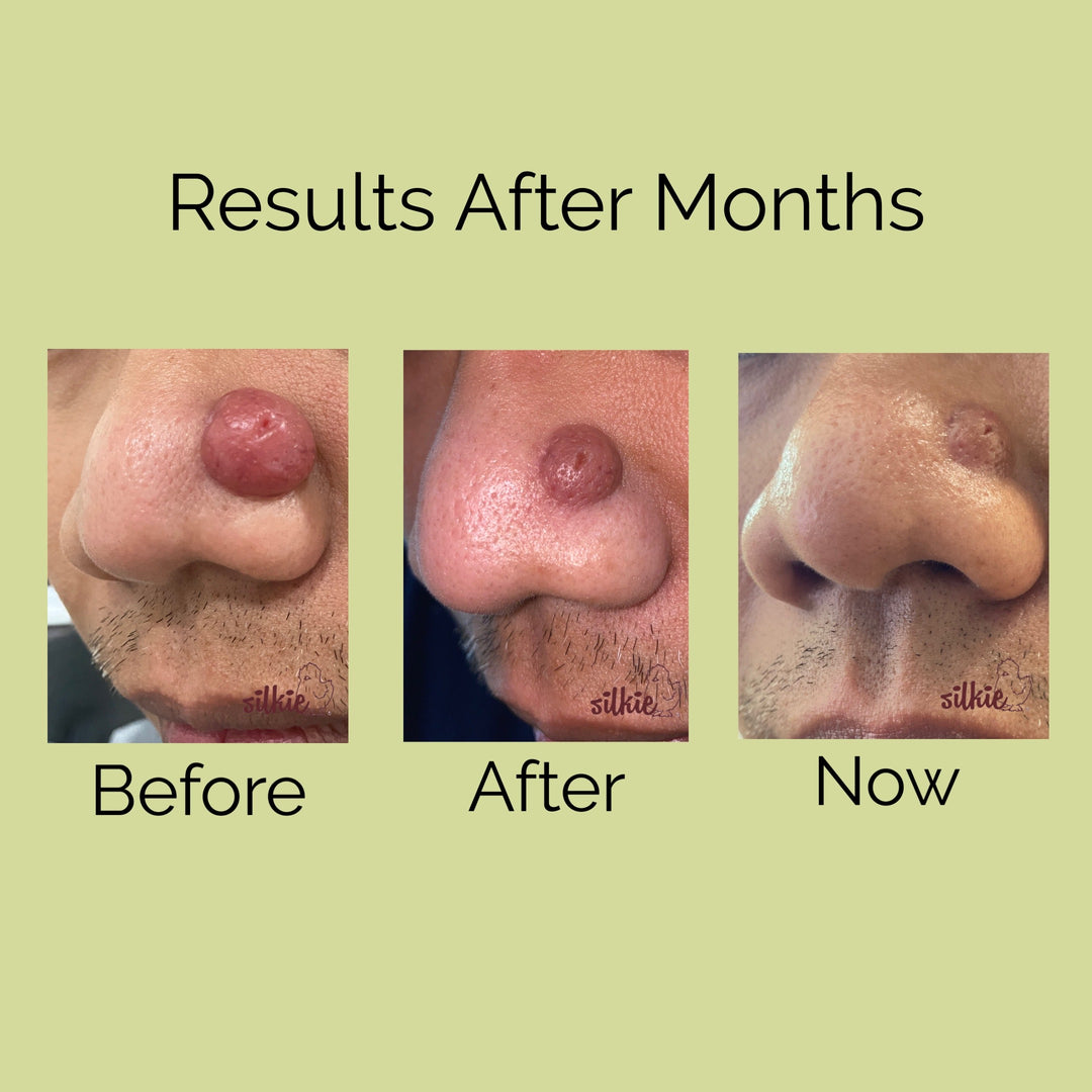 Mini Consultation: A 15 minute brief consultation to evaluate your health concerns, give herbal formula recommendations and answer your questions.