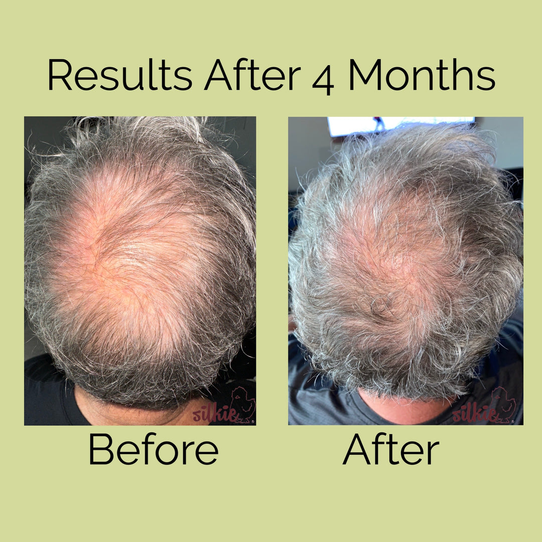 Mini Consultation: A 15 minute brief consultation to evaluate your health concerns, give herbal formula recommendations and answer your questions.