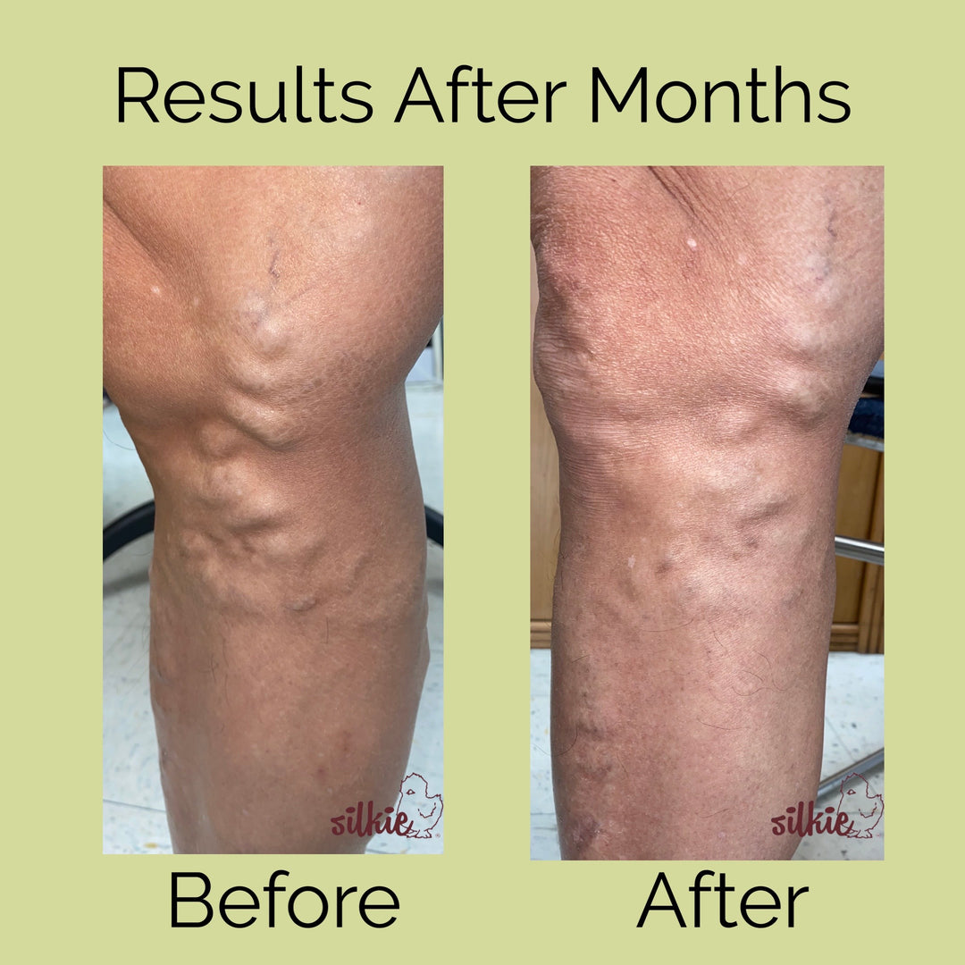 Mini Consultation: A 15 minute brief consultation to evaluate your health concerns, give herbal formula recommendations and answer your questions.