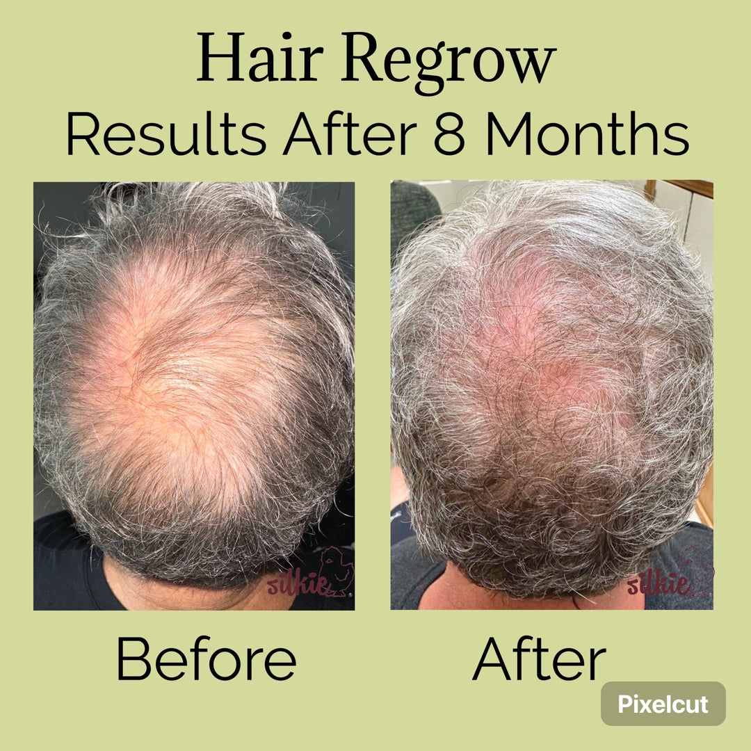 Before and After using Silkie Healthy Hair formula